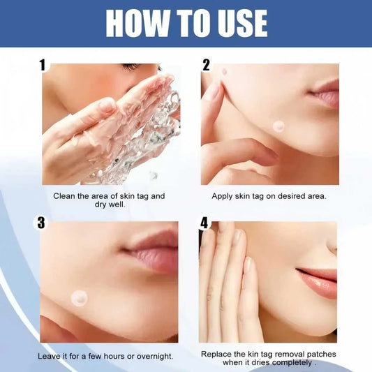 invisible Acne Pimple Patches (280 PCS)